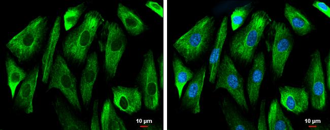 GSK3B Antibody in Immunocytochemistry (ICC/IF)