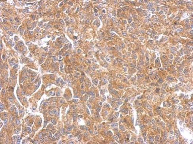 PAK1 Antibody in Immunohistochemistry (Paraffin) (IHC (P))