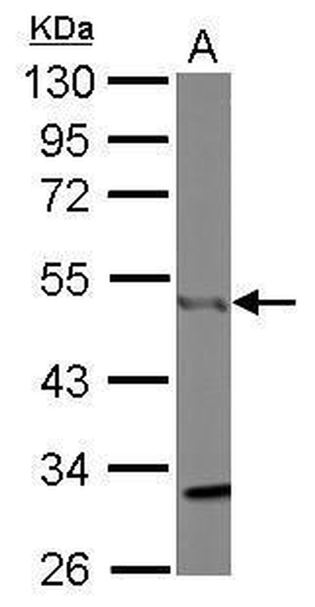 CtBP1 Antibody in Western Blot (WB)