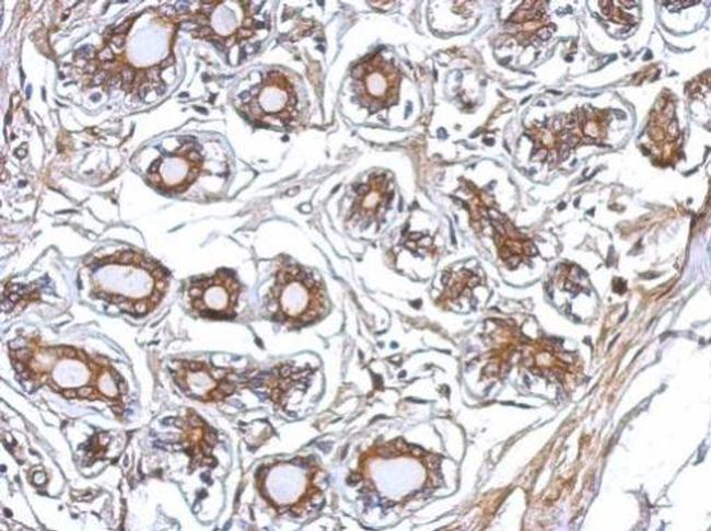 P2X7 Antibody in Immunohistochemistry (Paraffin) (IHC (P))