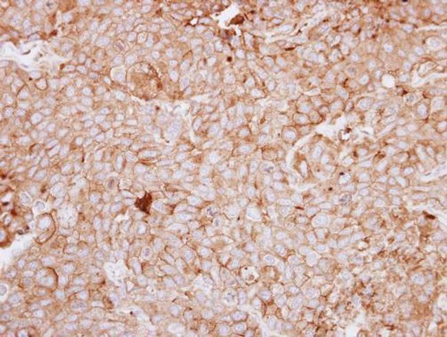 MCK10 Antibody in Immunohistochemistry (Paraffin) (IHC (P))