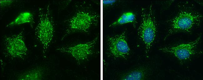 BCKDHA Antibody in Immunocytochemistry (ICC/IF)