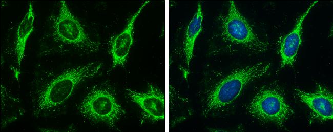 HK3 Antibody in Immunocytochemistry (ICC/IF)