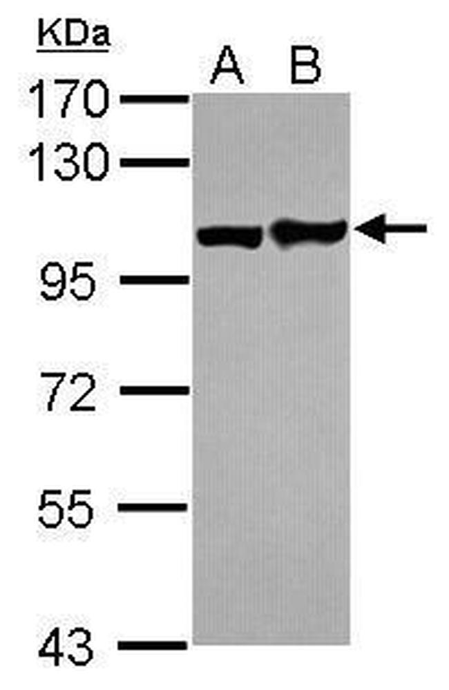 EphA1 Antibody in Western Blot (WB)