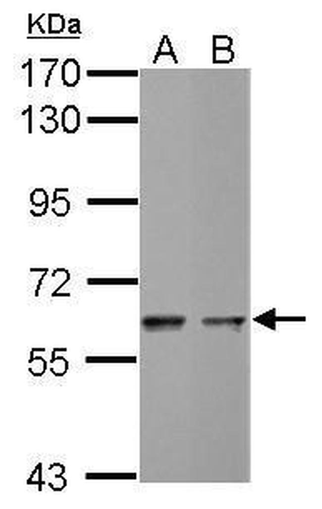 MST2 Antibody in Western Blot (WB)