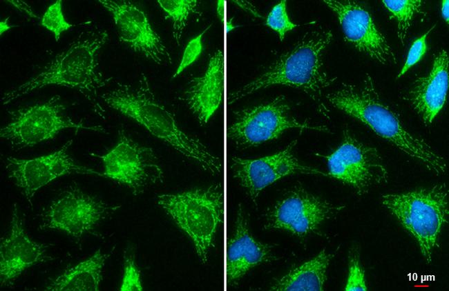 HK2 Antibody in Immunocytochemistry (ICC/IF)