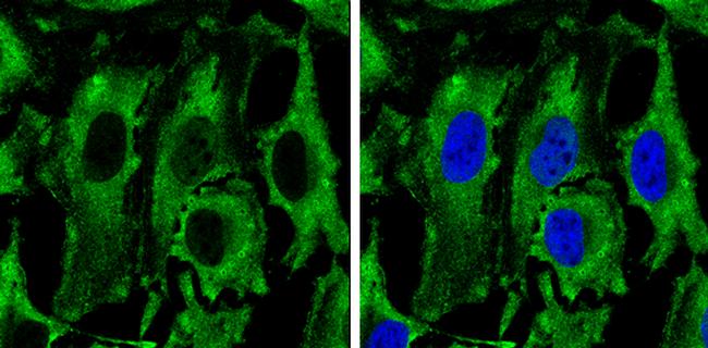 PKM2 Antibody in Immunocytochemistry (ICC/IF)