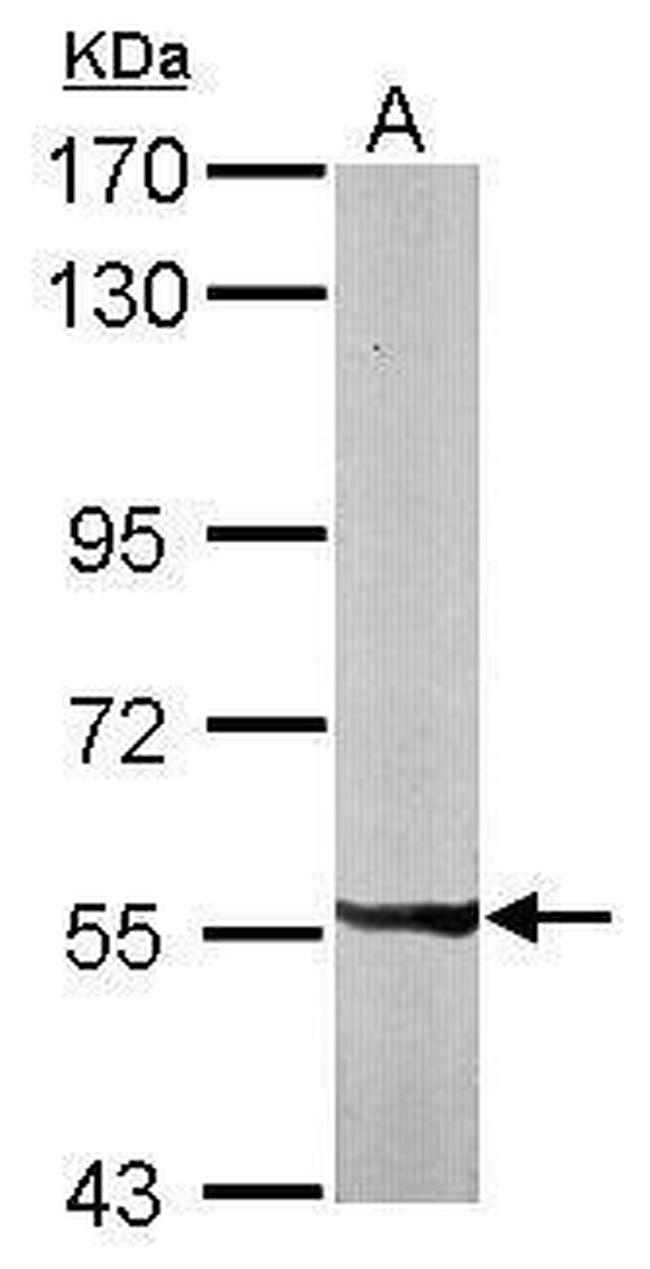 PXK Antibody in Western Blot (WB)