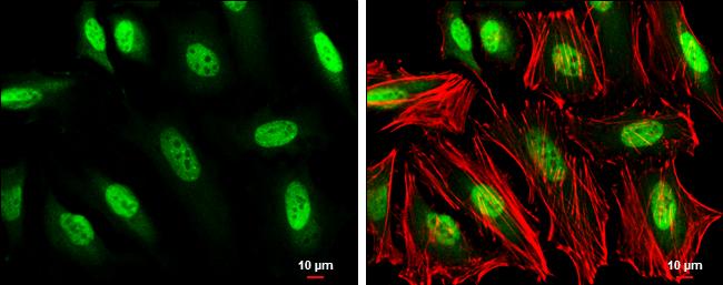 GTF2H1 Antibody in Immunocytochemistry (ICC/IF)