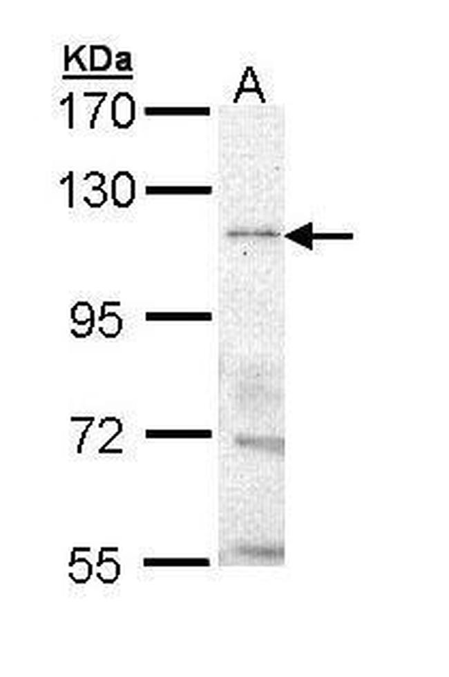 TRPM8 Antibody in Western Blot (WB)