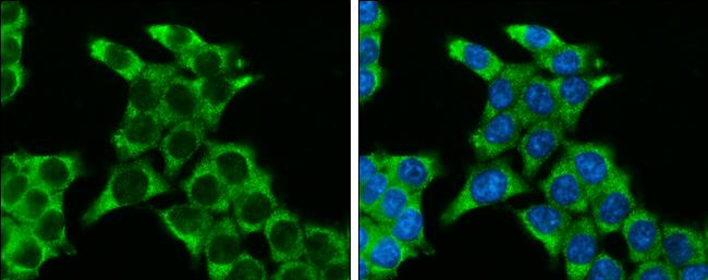 SFRP2 Antibody in Immunocytochemistry (ICC/IF)