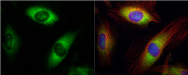 RPL17 Antibody in Immunocytochemistry (ICC/IF)