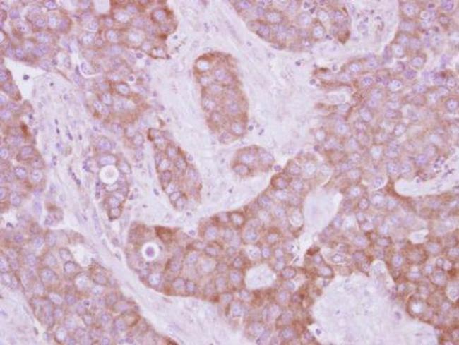 LOK Antibody in Immunohistochemistry (Paraffin) (IHC (P))