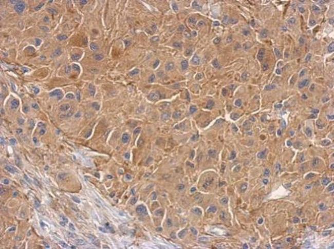 PCTAIRE1 Antibody in Immunohistochemistry (Paraffin) (IHC (P))