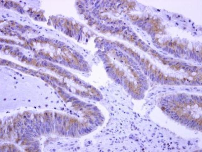 EPS8L2 Antibody in Immunohistochemistry (Paraffin) (IHC (P))