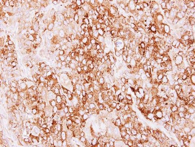 Creatine Kinase MT Antibody in Immunohistochemistry (Paraffin) (IHC (P))