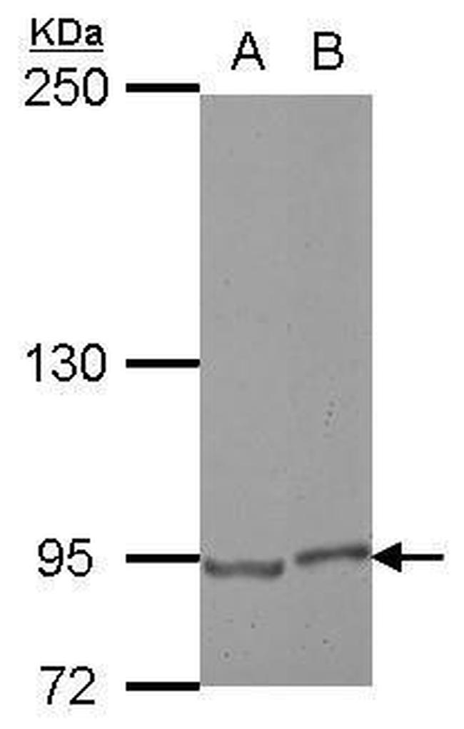 E2F8 Antibody in Western Blot (WB)