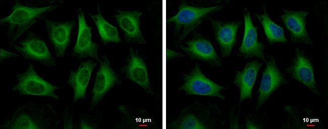 HMGCS1 Antibody in Immunocytochemistry (ICC/IF)