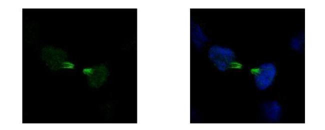 KID Antibody in Immunocytochemistry (ICC/IF)