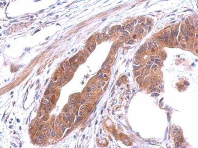 alanyl-tRNA Synthetase Antibody in Immunohistochemistry (Paraffin) (IHC (P))