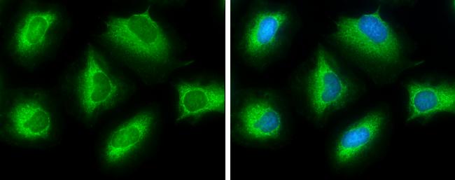 ATP Citrate Lyase Antibody in Immunocytochemistry (ICC/IF)