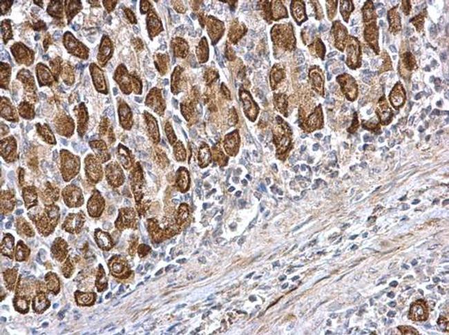 CDS1 Antibody in Immunohistochemistry (Paraffin) (IHC (P))