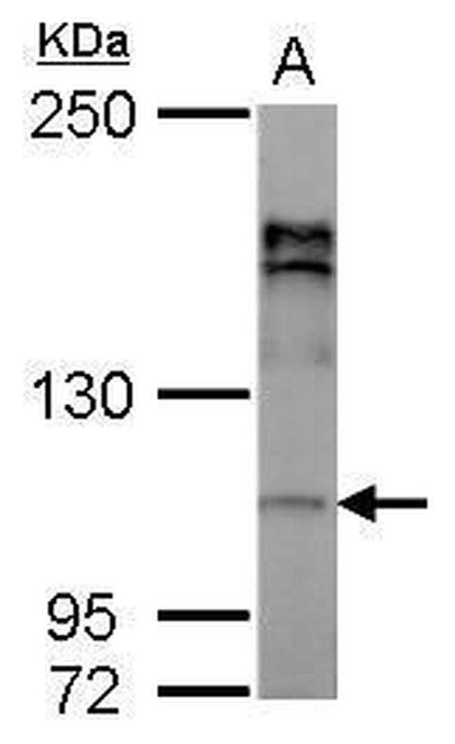 AP2A2 Antibody in Western Blot (WB)