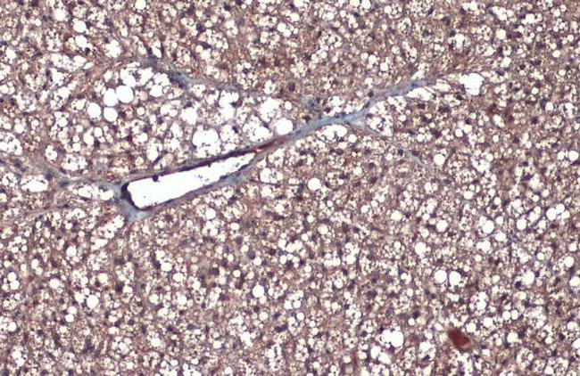 CD105 Antibody in Immunohistochemistry (Paraffin) (IHC (P))