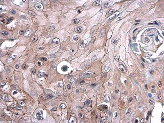 CD105 Antibody in Immunohistochemistry (Paraffin) (IHC (P))