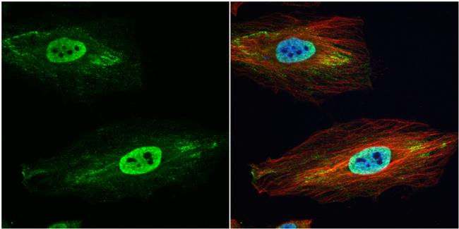 GSTP1 Antibody in Immunocytochemistry (ICC/IF)