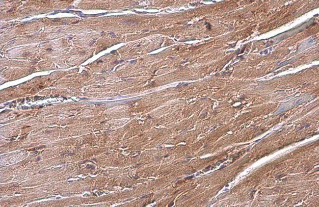 ANP Antibody in Immunohistochemistry (Paraffin) (IHC (P))