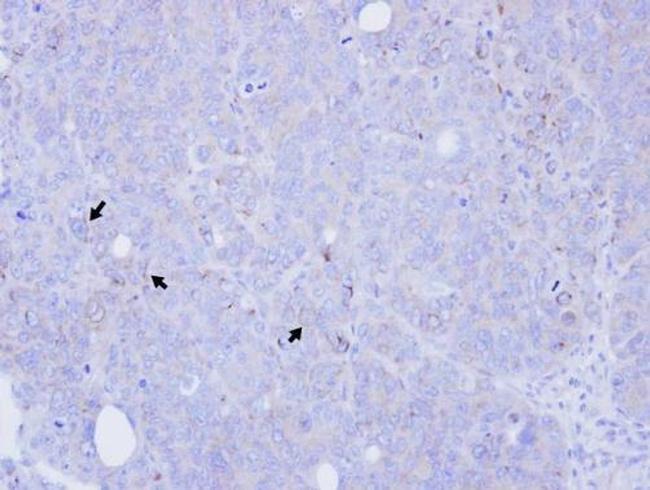 BST-1 Antibody in Immunohistochemistry (Paraffin) (IHC (P))