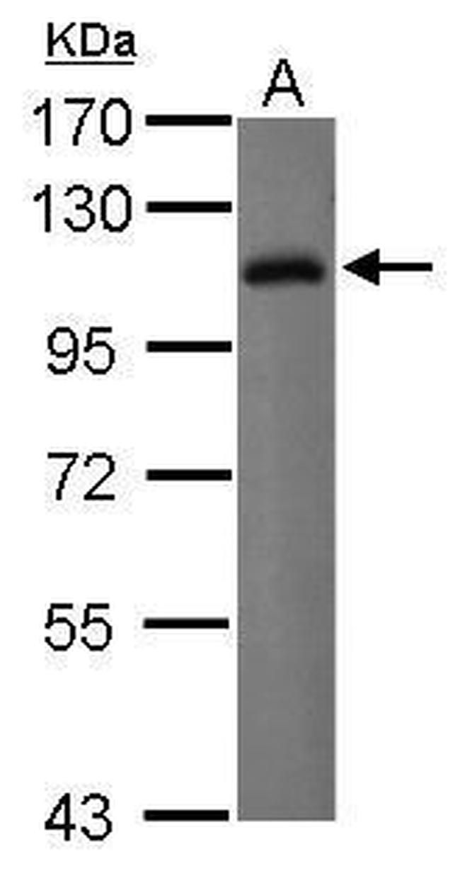 CD85j (ILT2) Antibody in Western Blot (WB)