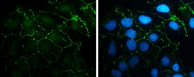 N-cadherin Antibody in Immunocytochemistry (ICC/IF)