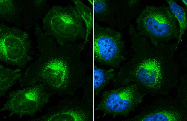 beta-2 Microglobulin Antibody in Immunocytochemistry (ICC/IF)