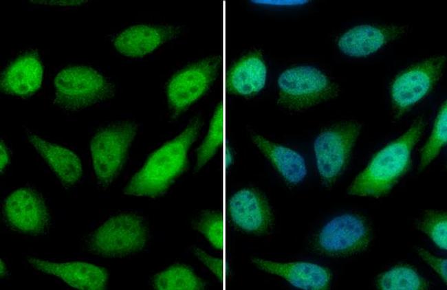 GSTP1 Antibody in Immunocytochemistry (ICC/IF)