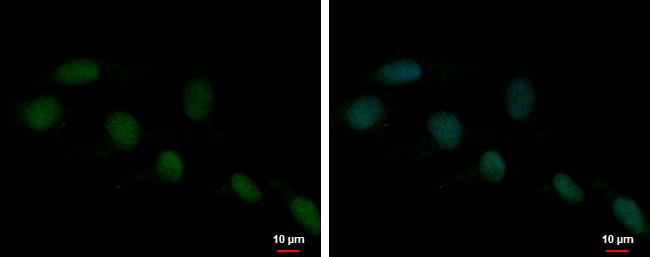 HMGB1 Antibody in Immunocytochemistry (ICC/IF)