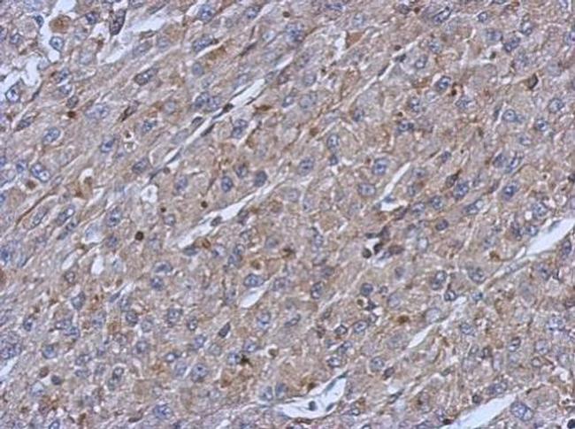 Cytokeratin 14 Antibody in Immunohistochemistry (Paraffin) (IHC (P))