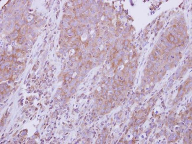 MyD88 Antibody in Immunohistochemistry (Paraffin) (IHC (P))