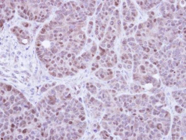 RPA70 Antibody in Immunohistochemistry (Paraffin) (IHC (P))