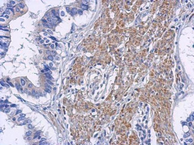 RIP2 Antibody in Immunohistochemistry (Paraffin) (IHC (P))