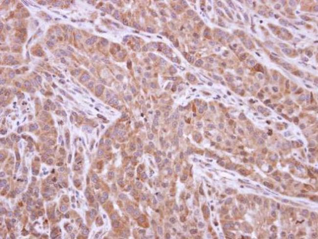 XIAP Antibody in Immunohistochemistry (Paraffin) (IHC (P))