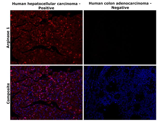 Arginase 1 Antibody in Immunohistochemistry (Paraffin) (IHC (P))