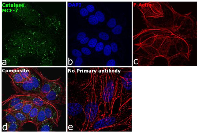 Catalase Antibody in Immunocytochemistry (ICC/IF)