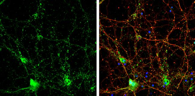 ChAT Antibody in Immunocytochemistry (ICC/IF)