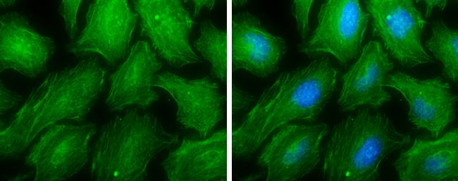 MYH9 Antibody in Immunocytochemistry (ICC/IF)