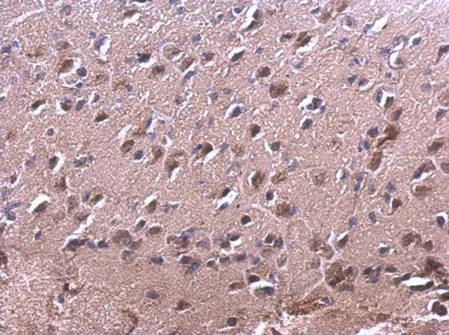 RAC2 Antibody in Immunohistochemistry (Paraffin) (IHC (P))