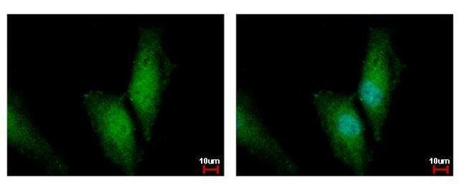 UBC13 Antibody in Immunocytochemistry (ICC/IF)