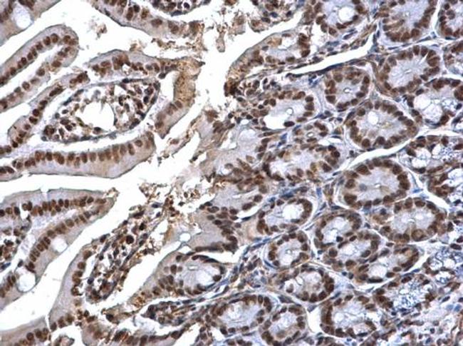 SMC1 Antibody in Immunohistochemistry (Paraffin) (IHC (P))