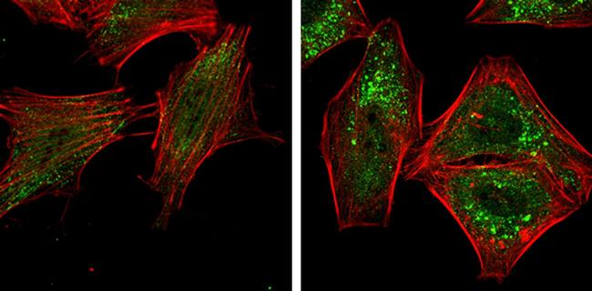 ATG5 Antibody in Immunocytochemistry (ICC/IF)